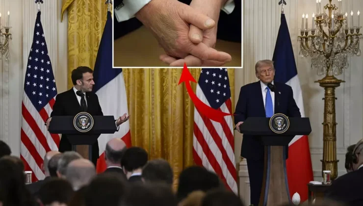 Beyaz Saray Trump’ın elindeki morluğa açıklık getirdi